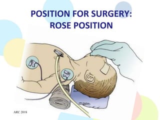 Cleft L-P (2).pptx