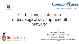 Cleft lip and palate from
embryological development till
maturity.
By
Dr. Khaled Wafaie
Master of science in orthodontics
University of Dundee
Orthodontic specialist at Smile Train and Operation
Smile
 