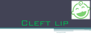 Cleft lip
Asok kumar RS OMFS
 