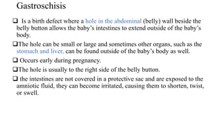Gastroschisis
 Is a birth defect where a hole in the abdominal (belly) wall beside the
belly button allows the baby’s intestines to extend outside of the baby’s
body.
The hole can be small or large and sometimes other organs, such as the
stomach and liver, can be found outside of the baby’s body as well.
 Occurs early during pregnancy.
The hole is usually to the right side of the belly button.
 the intestines are not covered in a protective sac and are exposed to the
amniotic fluid, they can become irritated, causing them to shorten, twist,
or swell.
 