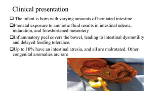 Clinical presentation
 The infant is born with varying amounts of herniated intestine
Prenatal exposure to amniotic fluid results in intestinal edema,
induration, and foreshortened mesentery
Inflammatory peel covers the bowel, leading to intestinal dysmotility
and delayed feeding tolerance.
Up to 10% have an intestinal atresia, and all are malrotated. Other
congenital anomalies are rare
 