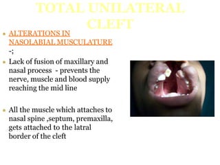 cleft lip.pptx