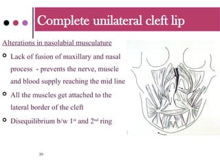 cleft lip and palate and its management.pptx