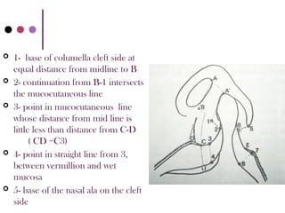 cleft lip and palate and its management.pptx