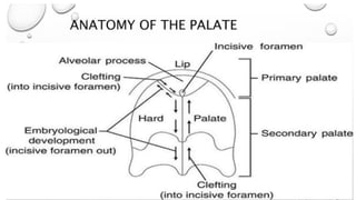 Comprehensive Overview of Cleft Lip and Palate: Embryology ...