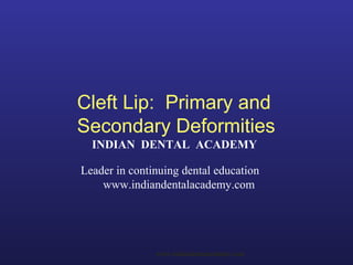 Cleft Lip: Primary and
Secondary Deformities
INDIAN DENTAL ACADEMY
Leader in continuing dental education
www.indiandentalacademy.com
www.indiandentalacademy.com
 