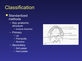 Cleft Lip-Primary & Secondary Deformities.ppt