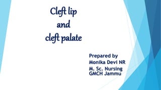 Cleft lip
and
cleft palate
Prepared by
Monika Devi NR
M. Sc. Nursing
GMCH Jammu
 