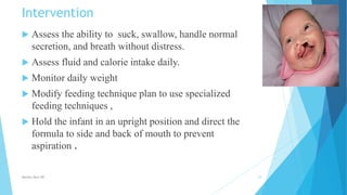 Intervention
 Assess the ability to suck, swallow, handle normal
secretion, and breath without distress.
 Assess fluid and calorie intake daily.
 Monitor daily weight
 Modify feeding technique plan to use specialized
feeding techniques ,
 Hold the infant in an upright position and direct the
formula to side and back of mouth to prevent
aspiration .
Monika Devi NR 10
 