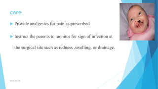 care
 Provide analgesics for pain as prescribed
 Instruct the parents to monitor for sign of infection at
the surgical site such as redness ,swelling, or drainage.
Monika Devi NR 15
 