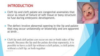 INTRODUCTION
 Cleft lip and cleft palate are congenital anomalies that
occur as result of failure of soft tissue or bony structure
to fuse during embryonic development.
 The defect involve abnormal opening in the lip and palate
that may occur unilaterally or bilaterally and are apparent
at birth .
 Cleft lip and cleft palate can occur on one or both sides of the
mouth. Because the lip and the palate develop separately, it is
possible to have a cleft lip without a cleft palate, a cleft palate
without a cleft lip, or both together
Monika Devi NR 3
 