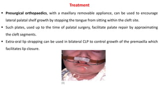 cleft lip and cleft palate.pdf