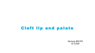 Cleft lip and palate
Nay Aung, BDS PhD
22.12.2022
 