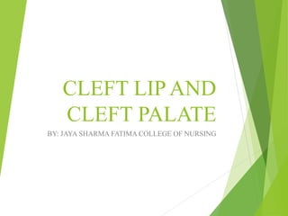 CLEFT LIP AND
CLEFT PALATE
BY: JAYA SHARMA FATIMA COLLEGE OF NURSING
 