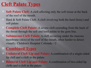 Comprehensive Overview of Cleft Lip and Cleft Palate: Causes ...