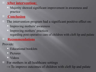 Comprehensive Overview of Cleft Lip and Cleft Palate: Causes ...