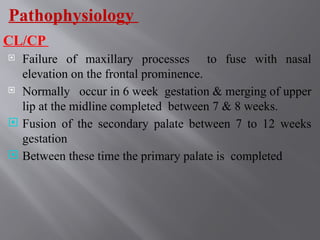 Comprehensive Overview of Cleft Lip and Cleft Palate: Causes ...
