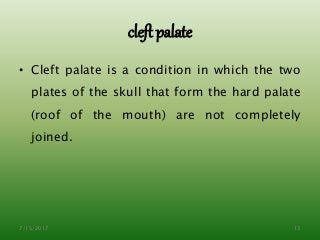 cleft palate
• Cleft palate is a condition in which the two
plates of the skull that form the hard palate
(roof of the mouth) are not completely
joined.
7/15/2017 13
 