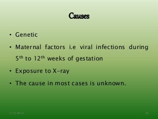 Causes
• Genetic
• Maternal factors i.e viral infections during
5th to 12th weeks of gestation
• Exposure to X-ray
• The cause in most cases is unknown.
7/15/2017 19
 