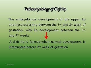 Pathophysiology of Cleft lip
The embryological development of the upper lip
and nose occurring between the 3rd and 8th week of
gestation, with lip development between the 3rd
and 7th weeks
A cleft lip is formed when normal development is
interrupted before 7th week of gestation
7/15/2017 24
 