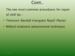 Cont..
The two most common procedures for repair
of cleft lip:-
• Tennison-Randall triangular flap(Z-Plasty)
• Millard rotationsl advancement technique
7/15/2017 30
 