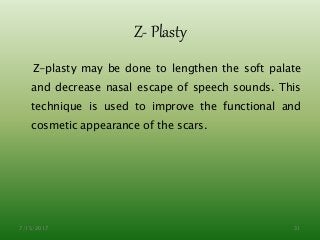 Z- Plasty
Z-plasty may be done to lengthen the soft palate
and decrease nasal escape of speech sounds. This
technique is used to improve the functional and
cosmetic appearance of the scars.
7/15/2017 31
 