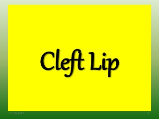 Cleft Lip
7/15/2017 5
 
