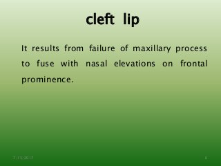 cleft lip
It results from failure of maxillary process
to fuse with nasal elevations on frontal
prominence.
7/15/2017 6
 