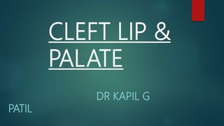 CLEFT LIP &
PALATE
DR KAPIL G
PATIL
 