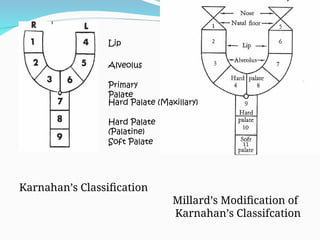 cleft lip and palate presentation for MBBS students | PPT