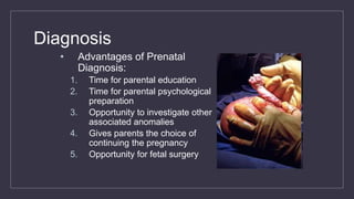 Diagnosis
• Advantages of Prenatal
Diagnosis:
1. Time for parental education
2. Time for parental psychological
preparation
3. Opportunity to investigate other
associated anomalies
4. Gives parents the choice of
continuing the pregnancy
5. Opportunity for fetal surgery
 