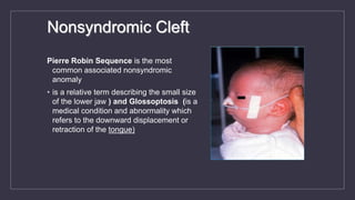 Nonsyndromic Cleft
Pierre Robin Sequence is the most
common associated nonsyndromic
anomaly
• is a relative term describing the small size
of the lower jaw ) and Glossoptosis (is a
medical condition and abnormality which
refers to the downward displacement or
retraction of the tongue)
 