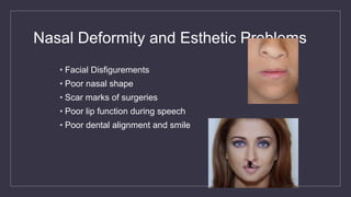 Nasal Deformity and Esthetic Problems
• Facial Disfigurements
• Poor nasal shape
• Scar marks of surgeries
• Poor lip function during speech
• Poor dental alignment and smile
 