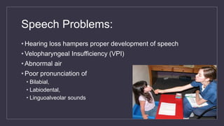 Speech Problems:
• Hearing loss hampers proper development of speech
• Velopharyngeal Insufficiency (VPI)
• Abnormal air
• Poor pronunciation of
• Bilabial,
• Labiodental,
• Linguoalveolar sounds
 