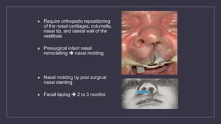  Require orthopedic repositioning
of the nasal cartilages, columella,
nasal tip, and lateral wall of the
vestibule
 Presurgical infant nasal
remodelling  nasal molding
 Nasal molding by post surgical
nasal stenting
 Facial taping  2 to 3 months
 