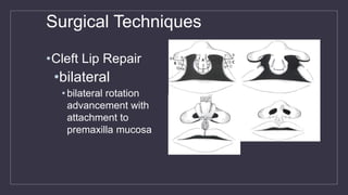 Surgical Techniques
•Cleft Lip Repair
•bilateral
• bilateral rotation
advancement with
attachment to
premaxilla mucosa
 