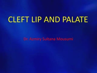 CLEFT LIP AND PALATE 
Dr. Azmiry Sultana Mousumi 
 