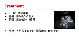 Treatment
● II ~ IV : 羊膜穿刺
● 唇裂 : 出生後3~6個月
● 顎裂 : 出生後9~18個月
● 預後 : 可能需多次手術 語言治療 牙科手術
 
