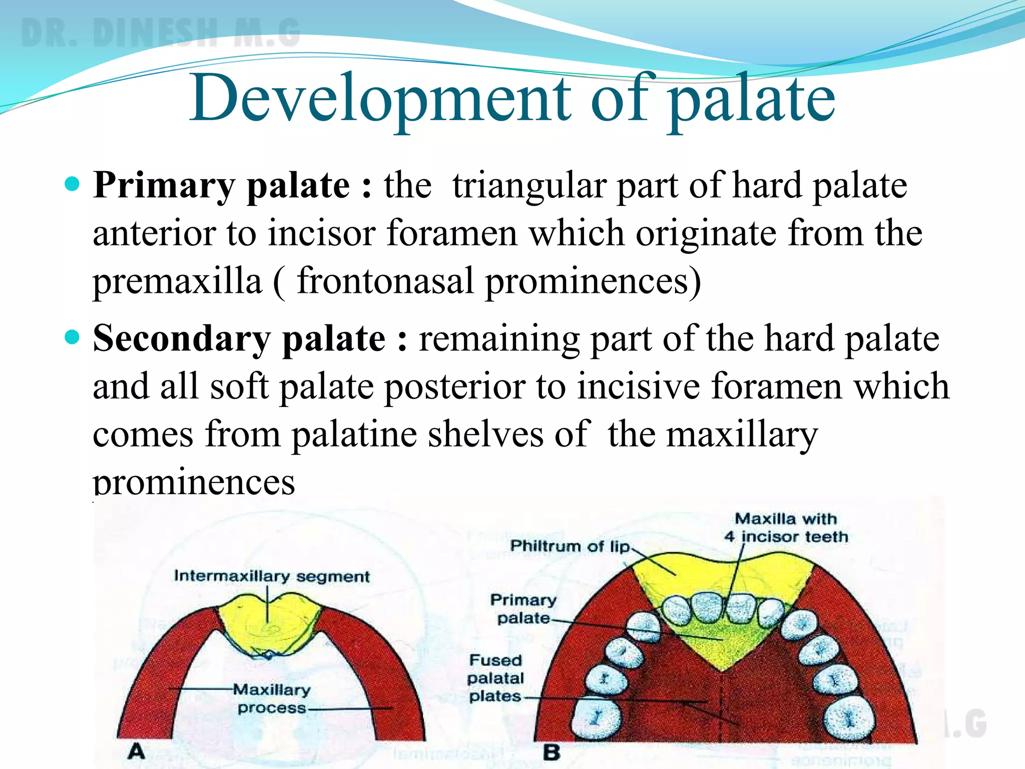 Cleft lip and palate | PDF