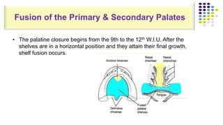 • The palatine closure begins from the 9th to the 12th W.I.U. After the
shelves are in a horizontal position and they attain their final growth,
shelf fusion occurs.
Fusion of the Primary & Secondary Palates
 
