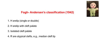 Fogh- Andersen’s classification (1942)
1. H arelip (single or double)
2. H arelip with cleft palate
3. Isolated cleft palate
4. R are atypical clefts, e.g., median cleft lip
 
