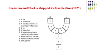 Kernahan and Stark’s stripped Y classification (1971)
 
