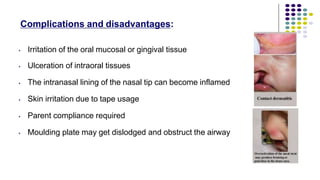 Complications and disadvantages:
•
•
•
•
•
•
Irritation of the oral mucosal or gingival tissue
Ulceration of intraoral tissues
The intranasal lining of the nasal tip can become inflamed
Skin irritation due to tape usage
Parent compliance required
Moulding plate may get dislodged and obstruct the airway
 