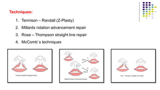 Techniques:
1. Tennison – Randall (Z-Plasty)
2. Millards rotation advancement repair
3. Rose – Thompson straight line repair
4. McComb`s techniques
 