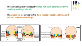 • These swellings simultaneously merge with each other and with the
maxillary swellings laterally.
• The upper lip is formed by the two medial nasal swellings and
the two maxillary swellings.
 