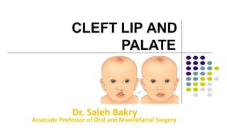CLEFT LIP AND
PALATE
Dr. Saleh Bakry
Associate Professor of Oral and Maxillofacial Surgery
 
