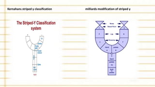 Kernahans striped y classification milliards modification of striped y
 