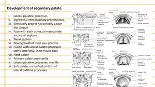 Development of secondary palate
i. Lateral palatine processes
ii. Ingrowths from maxillary prominences
iii. Eventually project horizontally above
the tongue
iv. Fuse with each other, primary palate
and nasal septum
v. Nasal septum
vi. Downgrowth of med. nas. promin.
vii. Fusion with lateral palatin processes
starts anteriorly, then moves back
viii. Hard palate
ix. Primary palate: premaxilla
x. Lateral palatine processes: maxilla
xi. Soft palate: unossified portion of
lateral palatine processes
 