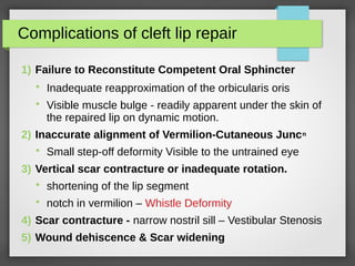 Cleft Lip and Palate | PDF