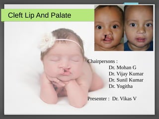 Cleft Lip And Palate
Chairpersons :
Dr. Mohan G
Dr. Vijay Kumar
Dr. Sunil Kumar
Dr. Yogitha
Presenter : Dr. Vikas V
 